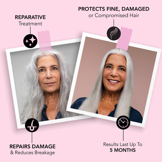 NKSTB Before and after model photo