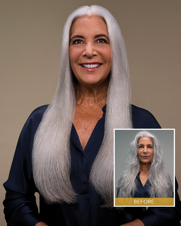 Treatment Aftercare Kit: NKSTB