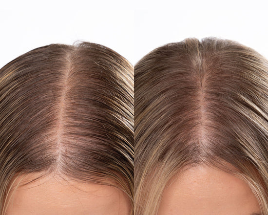 Before and after comparison of a hair part, showing a fuller, cleaner part after using dry shampoo.
